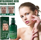 Fubsta 2 Pack Skin Firming Rejuvenating Serum. 97% Deep Wrinkle & Spot Eraser Serum ✨ | Hyaluronic Acid + Vitamin B5 + Madecassoside | Firming & Plumping Facial Serum | 80ml Luxury Size - Zeta Store