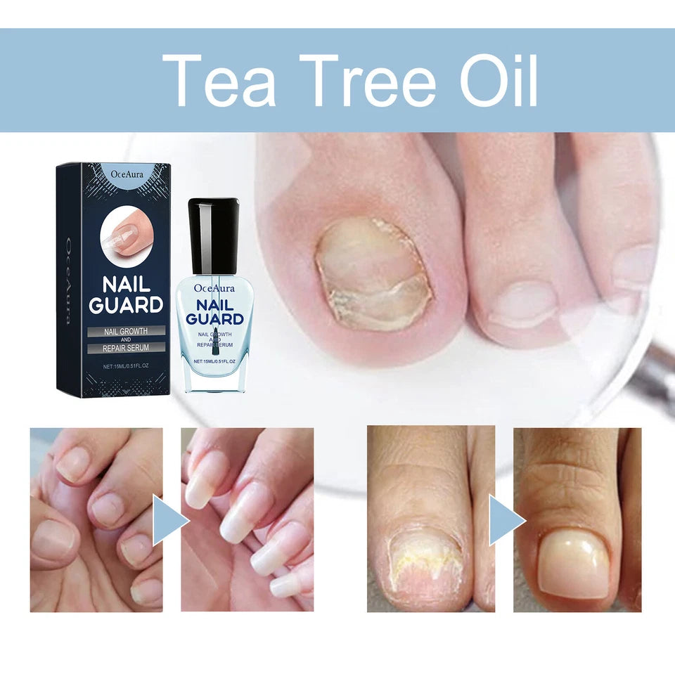 OceAura 2-Pack Nail Guard - Nail Growth and Repair Serum 15ml x2 - Nail Strengthening & Conditioning Serum