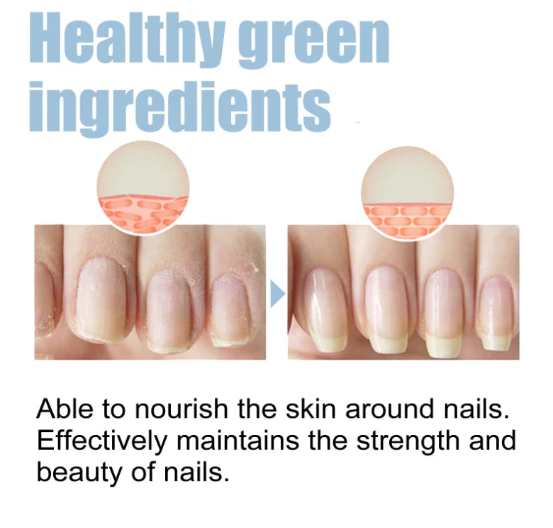 OceAura 2-Pack Nail Guard - Nail Growth and Repair Serum 15ml x2 - Nail Strengthening & Conditioning Serum