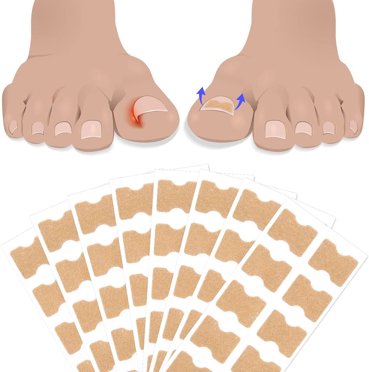 Sefudun Ingrown Toenail Correction Patches - 100PCS Elastic Corrector Stickers - No-Glue Toenail Care Strips