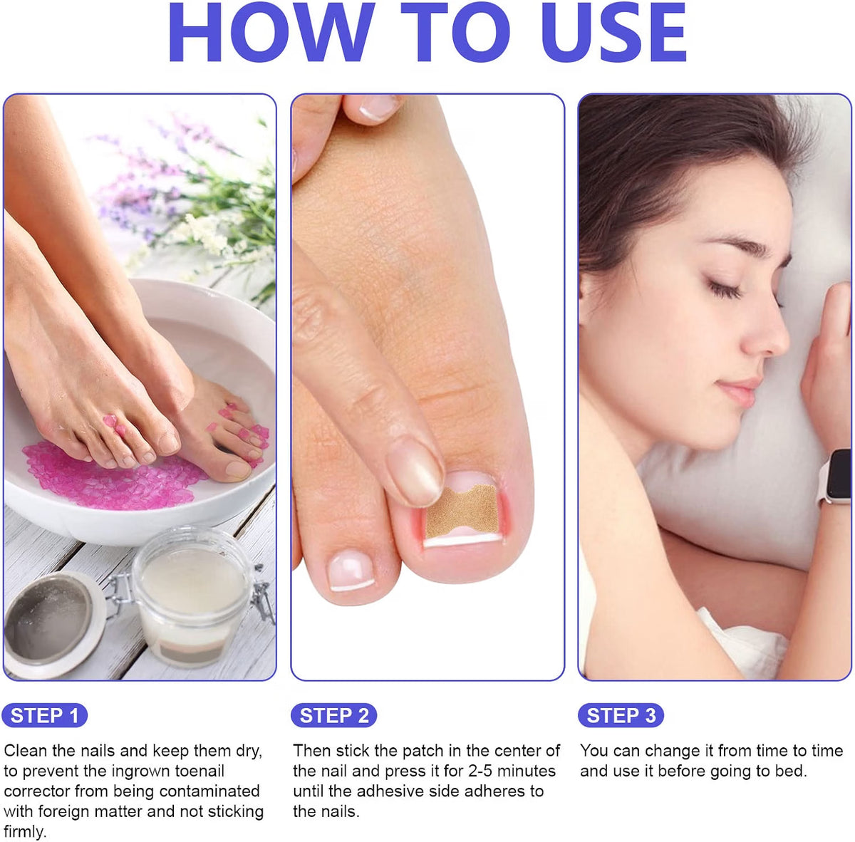 Sefudun Ingrown Toenail Correction Patches - 100PCS Elastic Corrector Stickers - No-Glue Toenail Care Strips