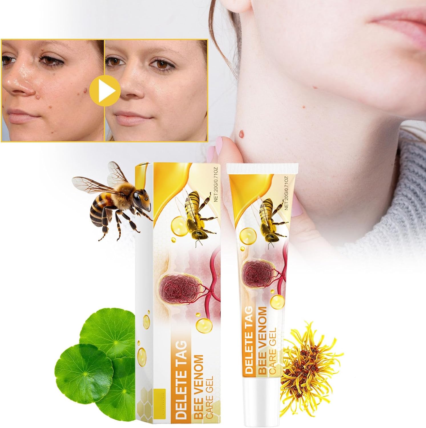 Ximonth 2 Pack. Delete Tag Bee Venom Care Gel ✨ | Professional Wart & Skin Tag Remover | 20g Fast-Acting Formula | Scar-Free Results | Brand New Barn Bargain! - Zeta Store